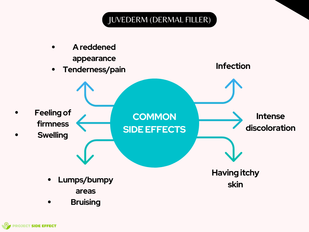common side effects of juvederm