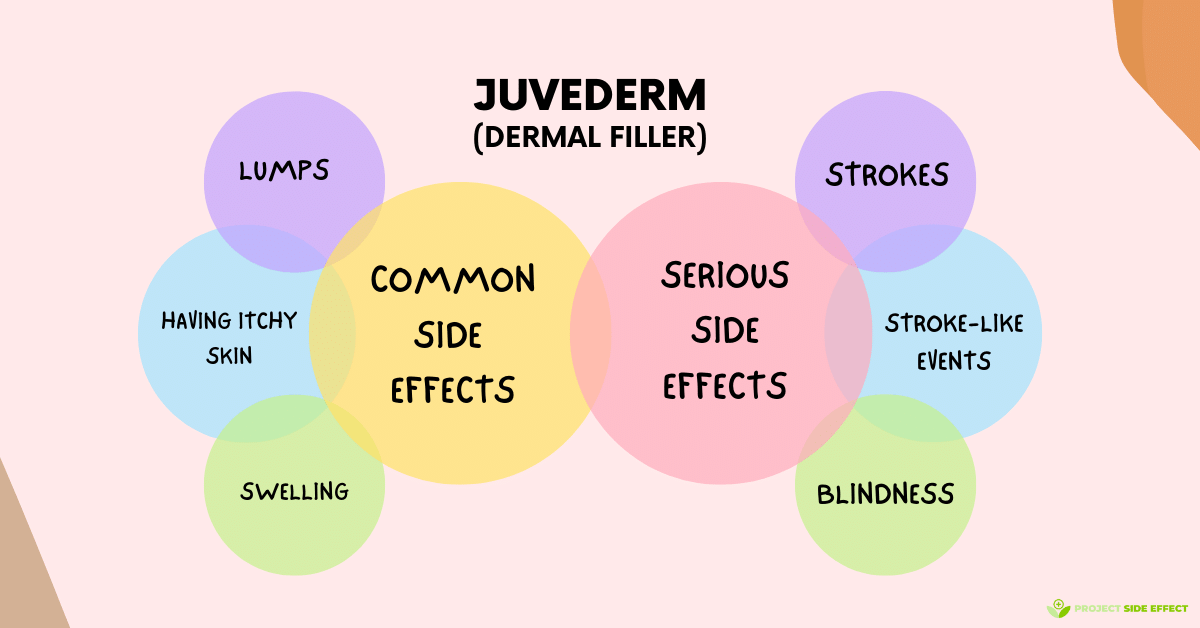 Is Juvederm Safe? Side Effects Of Juvederm